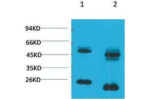 Western Blot (WB) analysis of 1) Rat Brain Tissue, 2)Mouse Brain Tissue with KV1.
