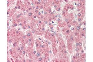 Human, Liver: Formalin-Fixed Paraffin-Embedded (FFPE).