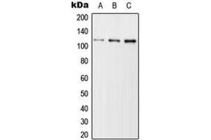 Western blot analysis of USP11 expression in Jurkat (A), SP2/0 (B), H9C2 (C) whole cell lysates.