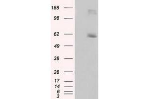 HEK293T cells were transfected with the pCMV6-ENTRY control (Left lane) or pCMV6-ENTRY LIPG (Right lane) cDNA for 48 hrs and lysed. (LIPG anticorps)