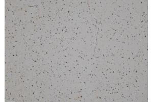 ABIN6257308 and ABIN6275887 at 1/100 staining Human heart tissue by IHC-P. (LHX1 anticorps  (Internal Region))