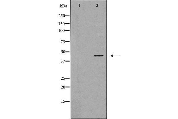 PRKAR1A anticorps  (N-Term)