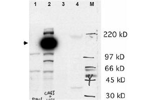 Image no. 1 for anti-Castor Zinc Finger 1 (CASZ1) (N-Term) antibody (ABIN401359) (CASZ1 anticorps  (N-Term))