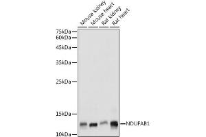 Western blot analysis of extracts of various cell lines, using NDUF antibody (ABIN7268817) at 1:1000 dilution. (NDUFAB1 anticorps  (AA 50-150))