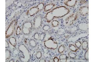 Immunoperoxidase of monoclonal antibody to DLD on formalin-fixed paraffin-embedded human kidney. (DLD anticorps  (AA 1-509))