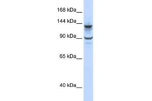 WB Suggested Anti-PGBD1 Antibody Titration:  0. (PGBD1 anticorps  (N-Term))