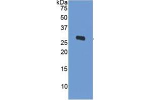 WB of Protein Standard: different control antibodies against Highly purified E. (ODC1 Kit ELISA)