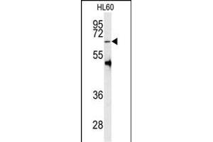 Western blot analysis of anti-PRMT5 Antibody (C-term ) (ABIN387841 and ABIN2843949) in HL60 cell line lysates (35 μg/lane). (PRMT5 anticorps  (C-Term))