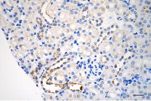 Immunohistochemistry was performed on paraffin-embedded mouse kidney using arg2 antibody (ABIN7797644), 1:200). (Recombinant ARG2 anticorps)