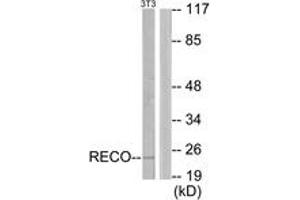 Western blot analysis of extracts from NIH-3T3 cells, using Recoverin Antibody. (Recoverin anticorps  (AA 107-156))