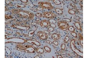 Detection of ACTB in Human Kidney Tissue using Monoclonal Antibody to Beta Actin (ACTB)