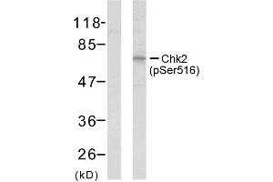 Western blot analysis of extracts from HeLa cells using Chk2 (phospho-Ser516) antibody (E011147). (CHEK2 anticorps  (pSer516))