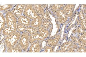 Detection of MMP8 in Human Kidney Tissue using Monoclonal Antibody to Matrix Metalloproteinase 8 (MMP8) (MMP8 anticorps  (AA 101-467))
