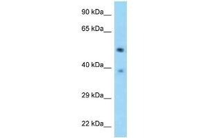 WB Suggested Anti-TSEN2 Antibody Titration: 1. (TSEN2 anticorps  (C-Term))