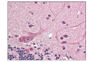 Image no. 1 for anti-Ring Finger Protein 25 (RNF25) (C-Term) antibody (ABIN303143) (RNF25 anticorps  (C-Term))