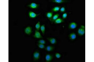 Immunofluorescence staining of A549 cells with ABIN7145776 at 1:133, counter-stained with DAPI.