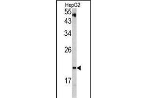 Western blot analysis of VHL antibody in HepG2 cell line lysates (35ug/lane)