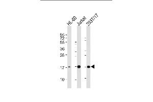 All lanes : Anti-SUMO3 Antibody at 1:2000 dilution Lane 1: HL-60 whole cell lysate Lane 2: Jurkat whole cell lysate Lane 3: 293T/17 whole cell lysate Lysates/proteins at 20 μg per lane. (SUMO3 anticorps)