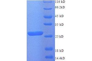 Zinc Finger, Matrin Type 2 (ZMAT2) (AA 1-194), (partial) protein (His tag)