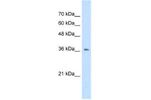 WB Suggested Anti-NUDT9 Antibody Titration:  0. (NUDT9 anticorps  (N-Term))