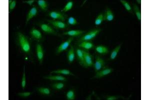Immunofluorescence staining of Hela cells with ABIN7143836 at 1:133, counter-stained with DAPI.