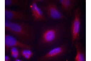 Immunofluorescence staining of methanol-fixed HeLa cells using TrkA (Phospho-Ser791) Antibody (E011326, Red) (TRKA anticorps  (pSer791))