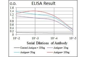 anti-Eukaryotic Translation Initiation Factor 4B (EIF4B) antibody