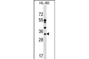 DNAJC17 Antibody (C-term) (ABIN1536940 and ABIN2849473) western blot analysis in HL-60 cell line lysates (35 μg/lane). (DNAJC17 anticorps  (C-Term))