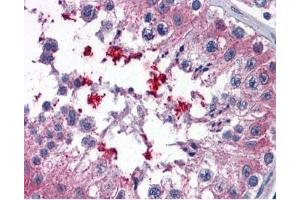 IHC testing of FFPE human testis tissue with ABCD4 antibody at 3. (ABCD4 anticorps)