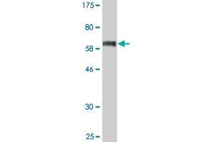 Western Blot detection against Immunogen (63. (STEAP1 anticorps  (AA 1-339))