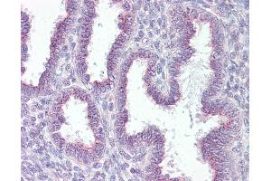 Anti-RER1 antibody IHC of human uterus. (RER1 anticorps  (AA 179-192))