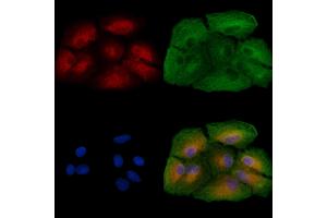 ABIN6257123 and ABIN6273439 staining  cells by IF/ICC. (Cyclin Y anticorps  (Internal Region))