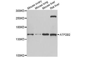 Western blot analysis of extracts of various cell lines, using ATP2B2 antibody. (ATP2B2 anticorps  (AA 1-80))