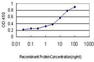 Detection limit for recombinant GST tagged DHODH is approximately 0. (DHODH anticorps  (AA 32-140))