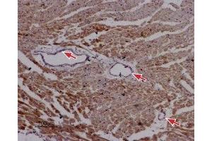 Expression of RyR2 in rat cardiac muscle - Immunohistochemical staining of paraffin-embedded sections of rat myocardium using Anti-Ryanodine Receptor 2 Antibody (ABIN7043605, ABIN7045213 and ABIN7045214), (1:50). (RYR2 anticorps  (Intracellular, N-Term))