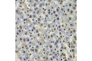 Immunohistochemistry of paraffin-embedded rat liver using IFI16 Antibody (ABIN6129036, ABIN6142162, ABIN6142163 and ABIN6218202) at dilution of 1:100 (40x lens). (IFI16 anticorps  (AA 1-300))