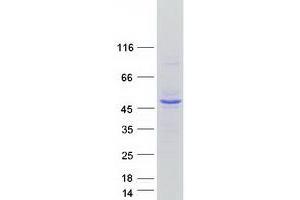 Validation with Western Blot