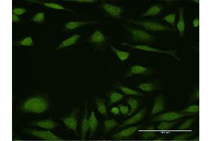 Immunofluorescence of purified MaxPab antibody to DEAF1 on HeLa cell.