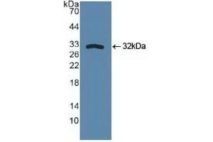 Western blot analysis of recombinant Human SPHK1. (SPHK1 anticorps  (AA 148-398))