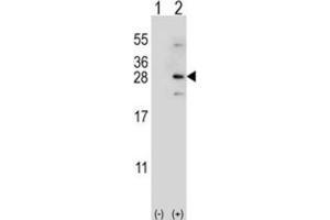 Western Blotting (WB) image for anti-NADH Dehydrogenase (Ubiquinone) Fe-S Protein 4, 18kDa (NADH-Coenzyme Q Reductase) (NDUFS4) antibody (ABIN3002889) (NDUFS4 anticorps)