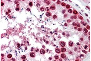 Human Testis: Formalin-Fixed, Paraffin-Embedded (FFPE)