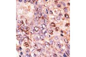 Image no. 2 for anti-ATP-Binding Cassette, Sub-Family B (MDR/TAP), Member 7 (ABCB7) (C-Term) antibody (ABIN358593)