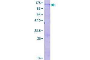 Image no. 1 for ATP-Binding Cassette, Sub-Family D (Ald), Member 1 (ABCD1) (AA 1-745) protein (GST tag) (ABIN1305469)