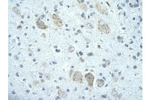 Rabbit Anti-FIP1L1 antibody        Paraffin Embedded Tissue:  Human Brain cell   Cellular Data:  Epithelial cells of renal tubule  Antibody Concentration:   4. (FIP1L1 anticorps  (C-Term))