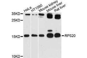 Western blot analysis of extracts of various cell lines, using RPS20 antibody (ABIN5998722) at 1/1000 dilution. (RPS20 anticorps)