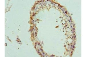 Immunohistochemistry of paraffin-embedded human testis tissue using ABIN7156846 at dilution of 1:100 (IL-20 anticorps  (AA 25-176))