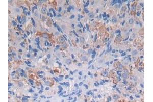 DAB staining on IHC-P; Samples: Mouse Ovary Tissue (PROZ anticorps  (AA 23-399))