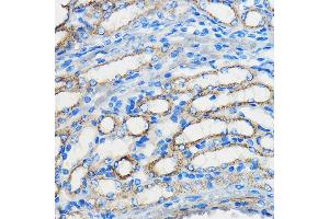 Immunohistochemistry of paraffin-embedded Mouse kidney using  antibody (ABIN3020671, ABIN3020672, ABIN1512605 and ABIN6213659) at dilution of 1:50 (40x lens).