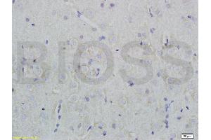 Formalin-fixed and paraffin embedded rat brain tissue labeled with Rabbit Anti-Nociceptin receptor Polyclonal Antibody (ABIN725960) at 1:200 followed by conjugation to the secondary antibody and DAB staining.