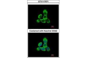 Image no. 3 for anti-Cytoglobin (CYGB) (AA 1-190) antibody (ABIN1501883)